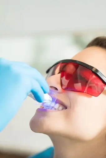 Sudden Discoloration of Teeth: Causes and Solutions